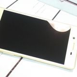 au Xperia X Perfomance SOV33 �饤�ॴ����� ��������  314